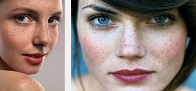 las famosas pecas